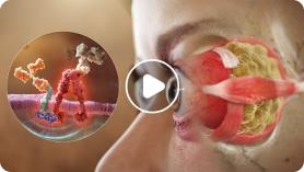 graves-eye-disease-pathophysiology-video-preview