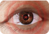 pain-behind-eye