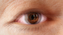 Artistic rendering of diplopia, or double vision, a common Thyroid Eye Disease symptom