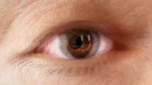 Artistic rendering of diplopia, or double vision, a common Thyroid Eye Disease symptom