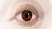 Artistic rendering vision loss caused by Thyroid Eye Disease